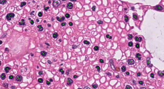 Automated cell counting